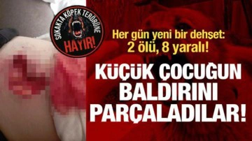 Başıboş k&ouml;pekler &ccedil;ocuğun bacağını par&ccedil;aladı! Her g&uuml;n yeni bir dehşet: 2 &ouml;l&uuml; 8 yaralı!