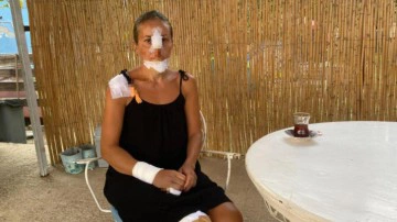 Erdek'te k&ouml;peklerinin saldırısına uğrayan kadın ve kızı scooterdan d&uuml;şt&uuml;