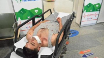 Otob&uuml;ste ayağına bastığı yolcuyu darbedip, palayla yaraladı