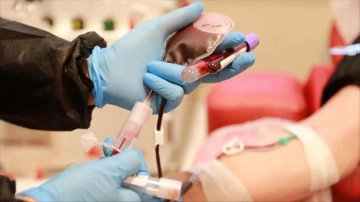 Trombosit nedir? Trombosit değerinin y&uuml;ksekliği ve d&uuml;ş&uuml;kl&uuml;ğ&uuml;: Nedenleri, belirtileri ve tedavisi